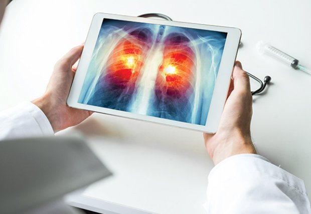 DHL Health News Otoño 2018 Noviembre - Exámenes de pulmón